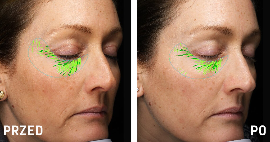 Before-after_web_article_Linda_1140x600_PL.jpg